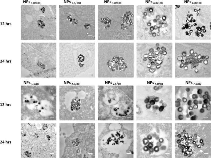 自己分解性SiO2ナノ粒子を用いた精密リソソームpHセンサーの開発